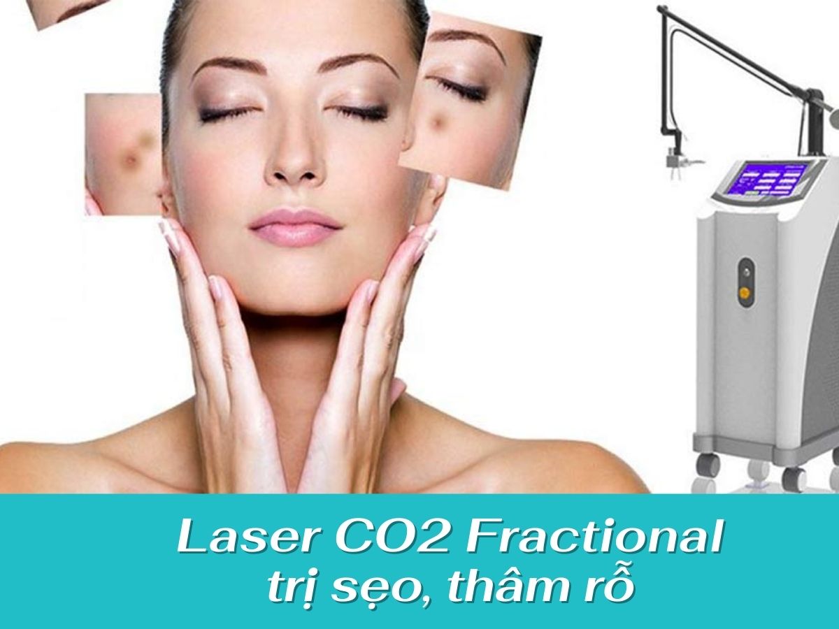 cô gái bị sẹo và máy laser trị sẹo