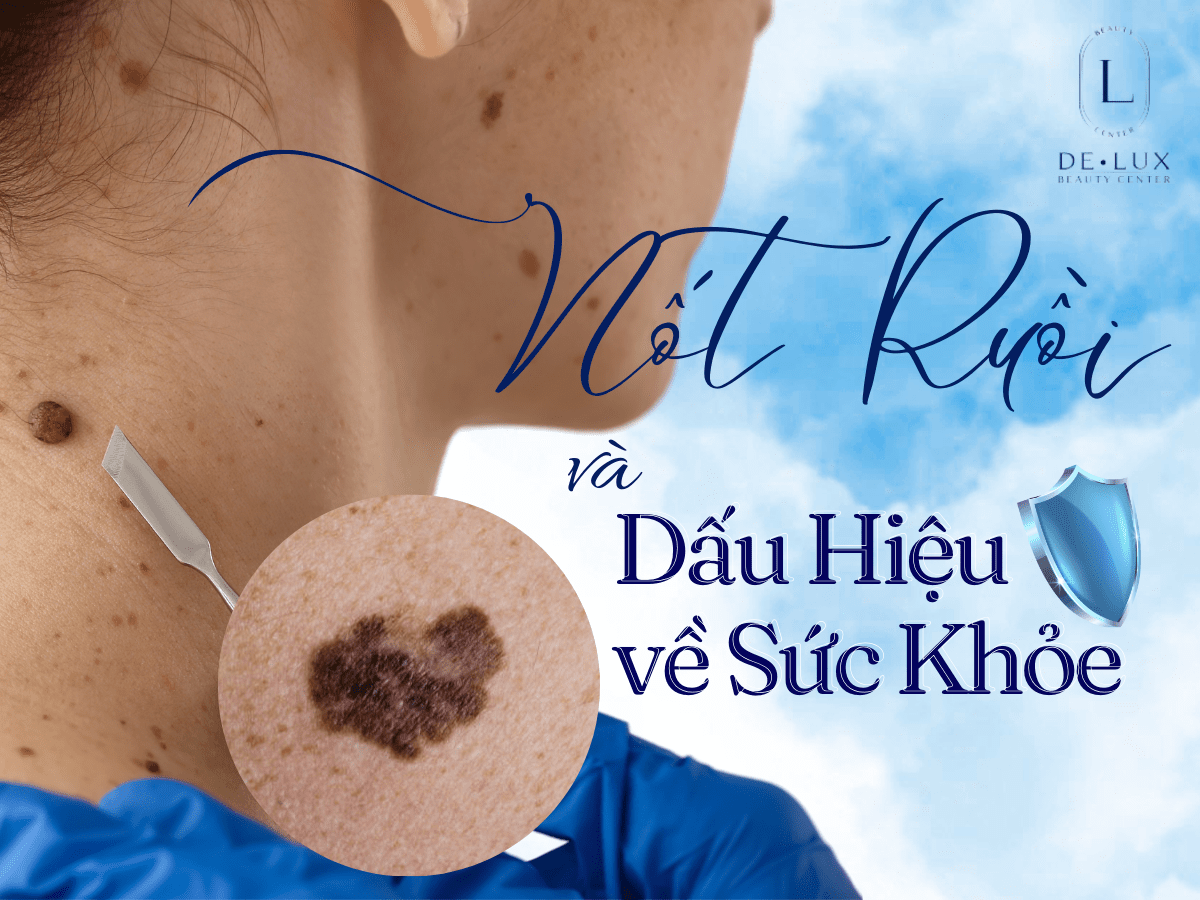 hình người và chữ nốt ruồi và tàn nhang