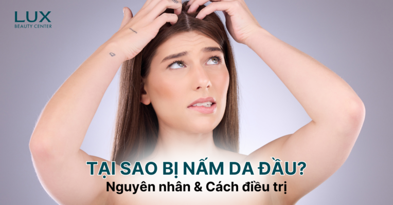 TẠI SAO BỊ NẤM DA ĐẦU? TÌM HIỂU NGUYÊN NHÂN BỊ NẤM DA ĐẦU VÀ CÁCH ĐIỀU TRỊ