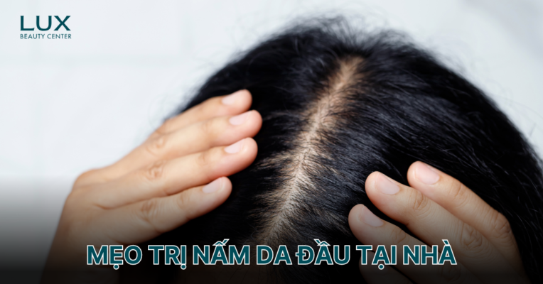 Cách trị nấm da đầu tại nhà hiệu quả