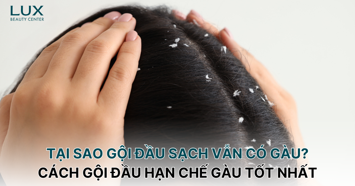 Tại sao gội đầu sạch vẫn có gàu