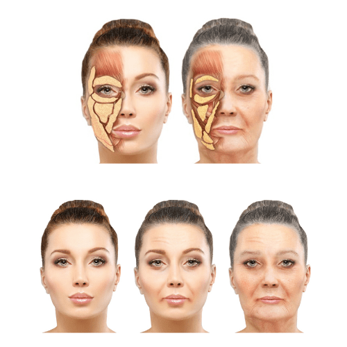 hình làn da của cô gái bị lão hóa