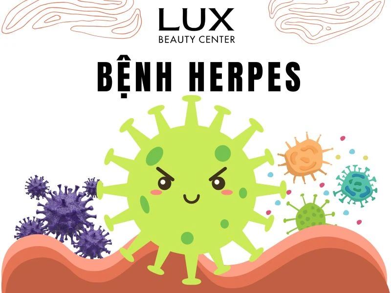 hình virus và chữ bệnh herpes