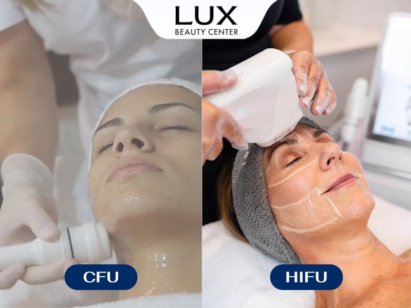 hình cô gái bên trái được thực hiện liệu trình cfu và cô gái bên phải thì thực hiện liệu trình hifu