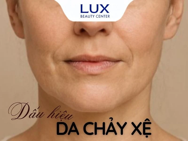 hình cô gái bị nếp nhăn ở rãnh mũi má và chữ da mặt chảy xệ phải làm sao