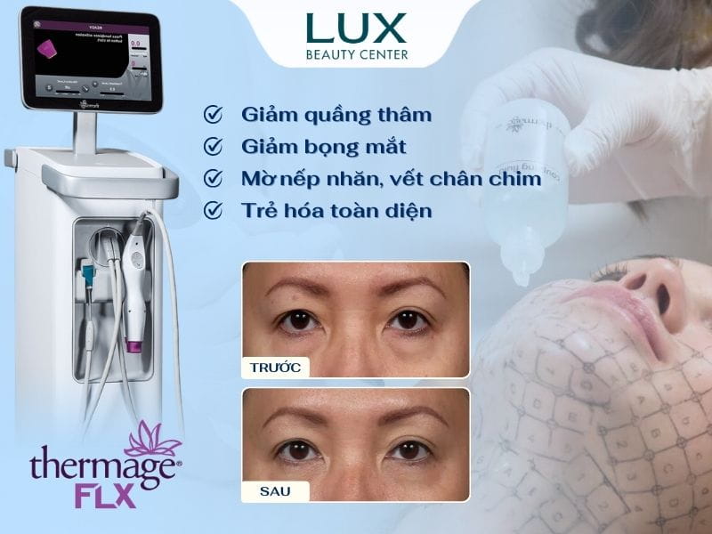 hình máy thermage flx và cô gái được bác sĩ điều trị và chữ