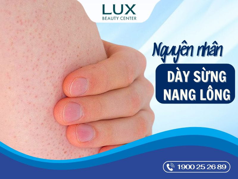 hình da bị dày sừng nang lông và chữ