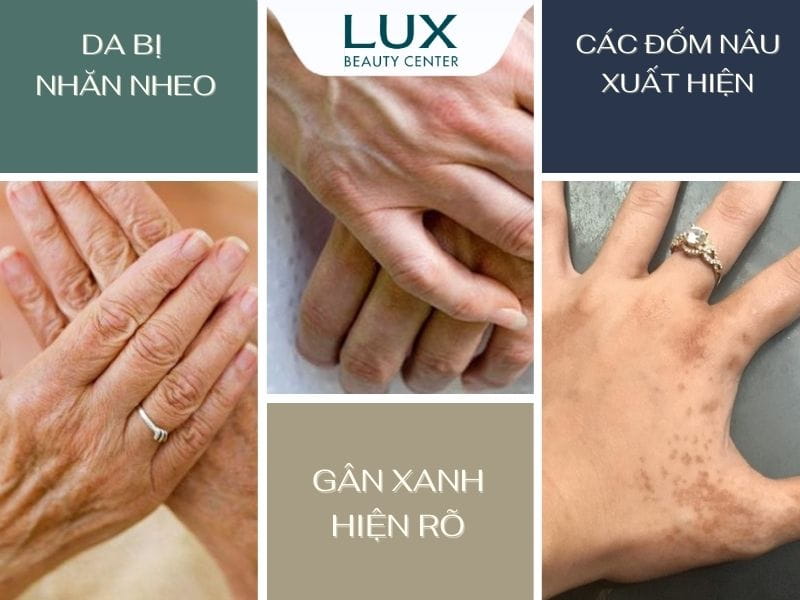 hình ảnh đôi bàn tay và chữ trẻ hóa da tay