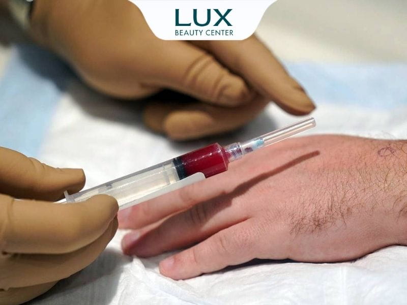 hình tiêm prp vào tay khách hàng