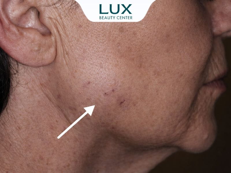 hình bác gái bị chảy xệ