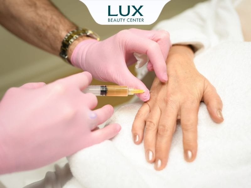 hình bác sĩ tiêm filler vào tay cho khách hàng