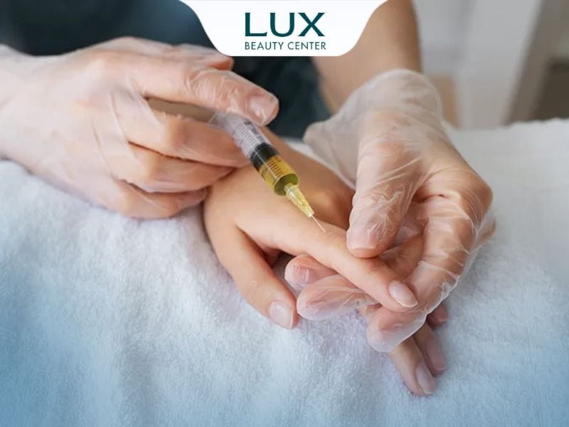 hình bác sĩ đang cấy mỡ vô da tay cho khách hàng
