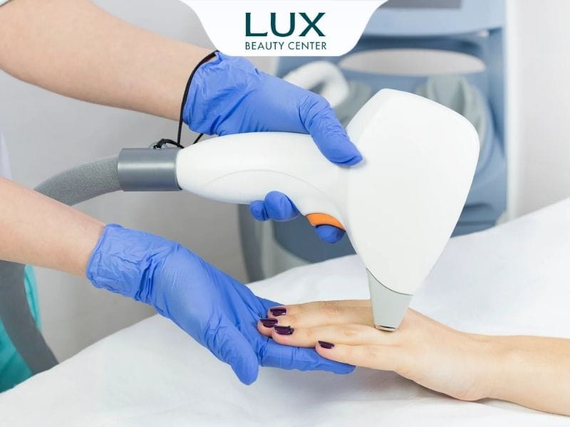 hình bác sĩ sử dụng máy laser điều chỉnh sắc tố da tay cho khách hàng