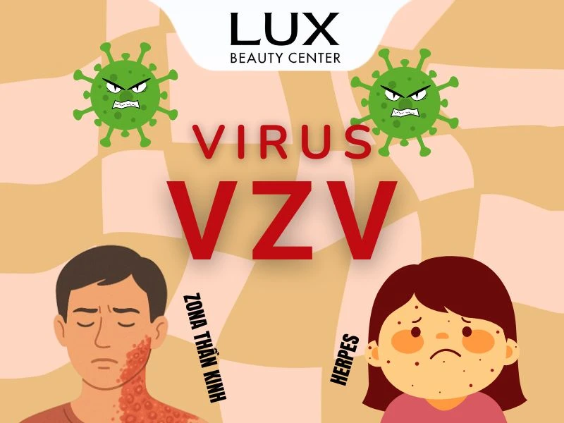 hình hai người bị zona thần kinh và herpes và chữ và virus